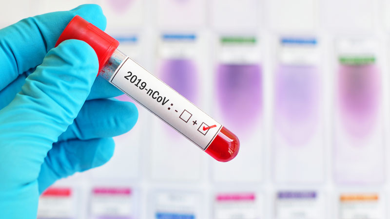 Coronavirus Piemonte: 22.562 guariti, a Torino e provincia sono 11.761 (+24)