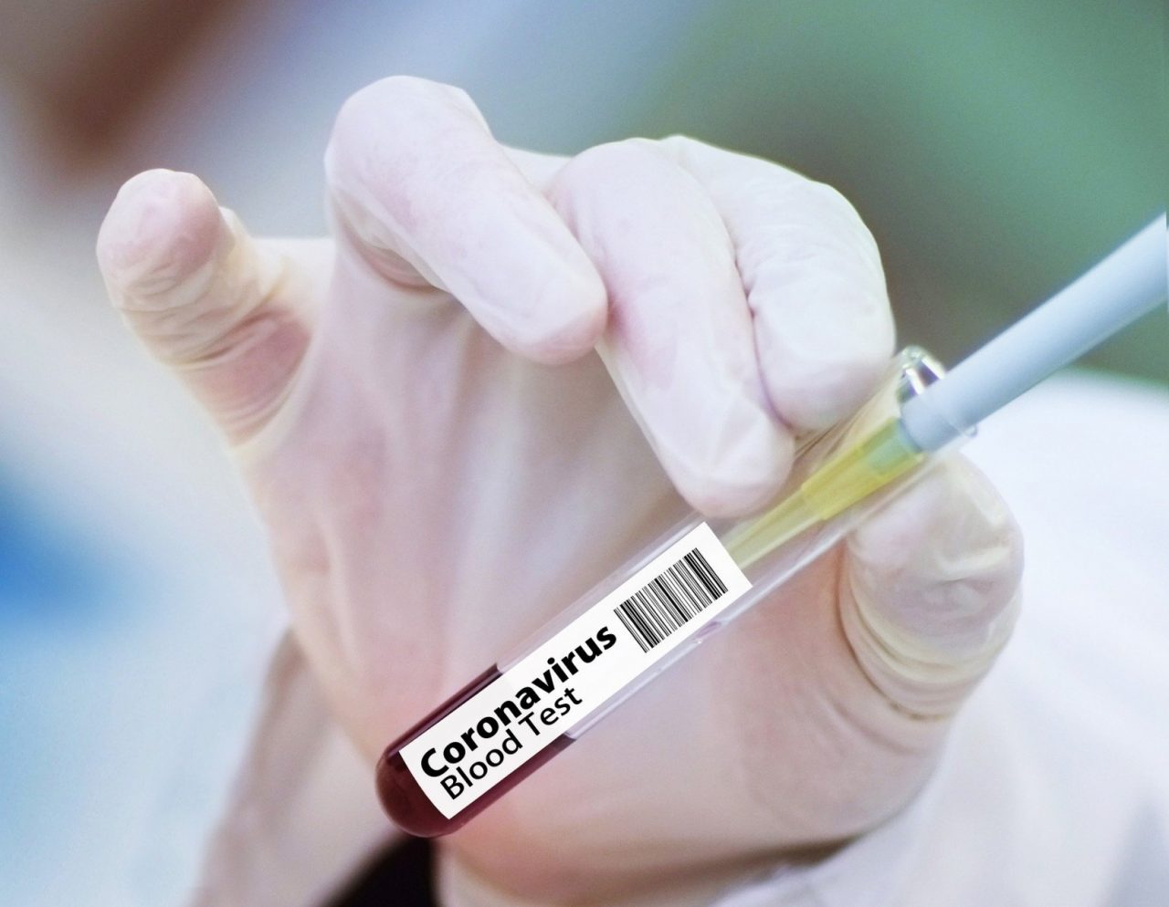 Test sierologici Diasorin-San Matteo: si indaga anche per epidemia colposa