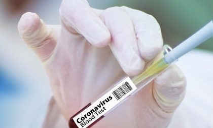 Test sierologici Diasorin-San Matteo: si indaga anche per epidemia colposa