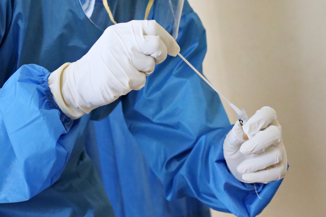 “Allarmismi e informazioni non verificate” l’assessore alla Ricerca Covid, Matteo Marnati risponde alle accuse dell’Associazione Medici dirigenti