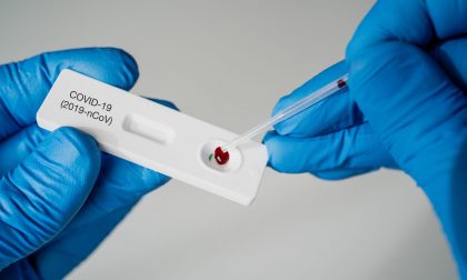 Test sierologici, il Consiglio di Stato legittima l’accordo tra San Matteo di Pavia e Diasorin