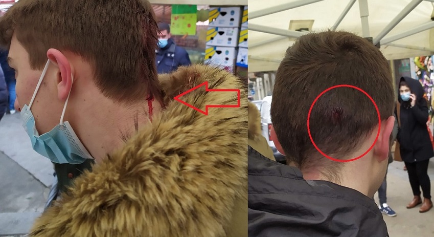 Aggressione ai militanti di destra: identificati due “picchiatori”