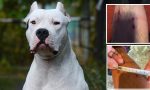 Aggredito e morsicato da un grosso dogo argentino