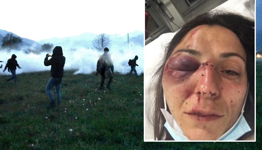 No Tav ferita negli scontri: gli attivisti contro i giornali e la versione ufficiale