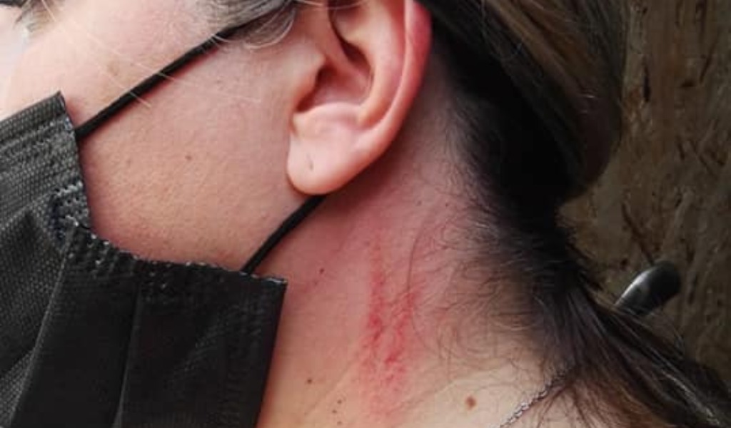 Esponente di Fratelli d’Italia accerchiata e aggredita da spacciatori a Barriera Milano