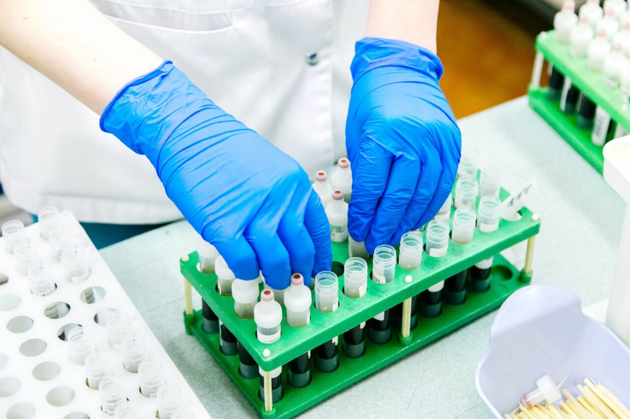 Il nostro sistema immunitario è ancora protetto contro il Covid? Ce lo dice un test