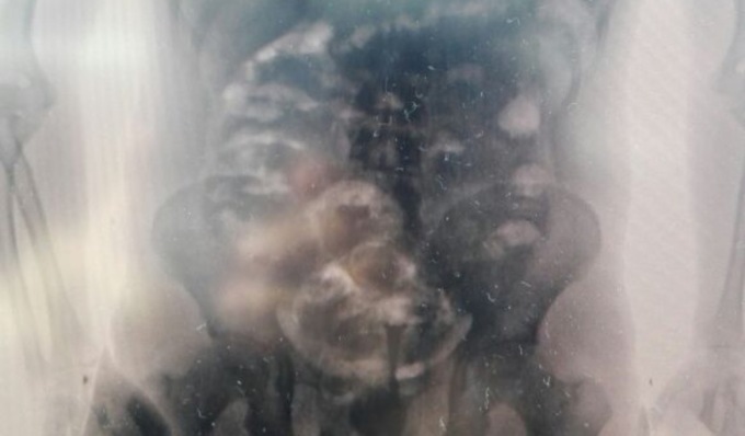 I soldi della droga investiti in vigneti: due corrieri “ovulatori” arrestati a Torino