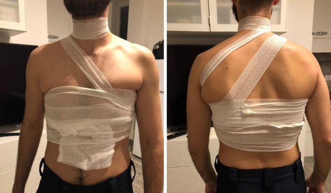 Carcere di Torino sempre più nel “caos”: detenuto getta liquido urticante addosso a un Agente