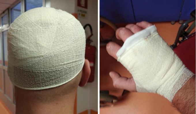 Ancora aggressioni in carcere a Torino: 4 agenti in ospedale, uno rimedia 40 punti di sutura in testa