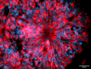 La ricerca di UniTo: scoperto un nuovo gene responsabile dell’autismo