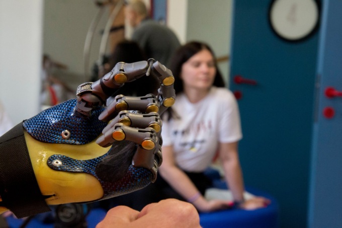 Quattro soldati ucraini riavranno mani e braccia grazie a protesi bioniche studiate a Torino