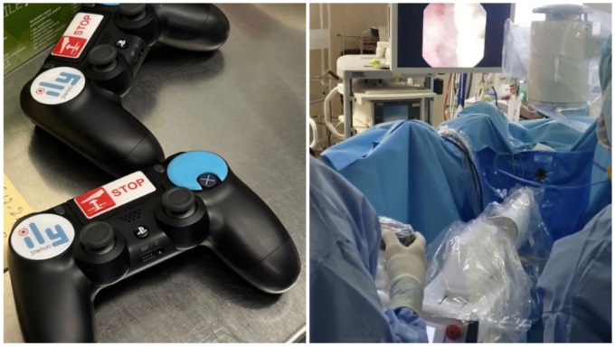 50enne coi calcoli renali operato a Torino con… un joystick della PlayStation