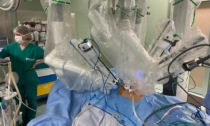 Ospedale Molinette: tumore al torace asportato per la prima volta da un robot con una piccola incisione