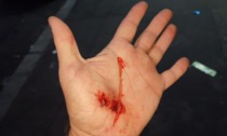 Parco della Confluenza: runner aggredito con un coltello