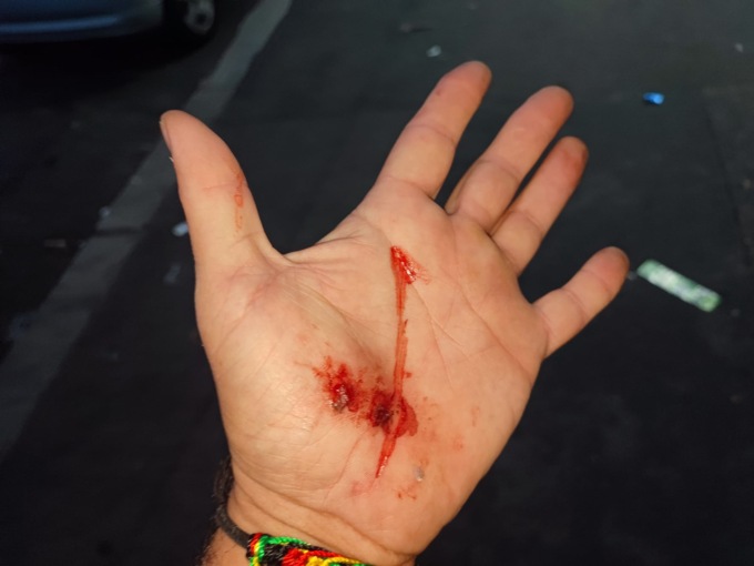 Parco della Confluenza: runner aggredito con un coltello