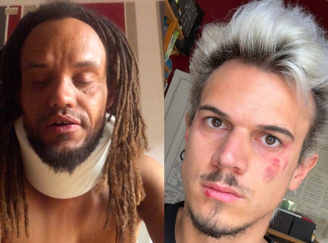 Ondata di violenza a Torino: insulti razzisti e botte al clown Idà, solo poche ore prima l’aggressione all’influencer Pietro Morello