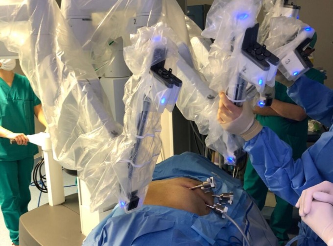 Molinette di Torino: intervento miniinvasivo per salvare un 51enne con massa tumorale sopra il cuore