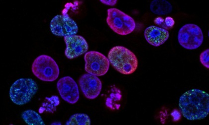 Una nuova prospettiva terapeutica del colon-retto